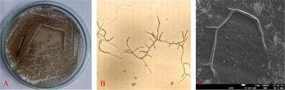 Antibacterial and Antioxidant Activities of Novel Actinobacteria Strain Isolated from Gulf of Khambhat, Gujarat